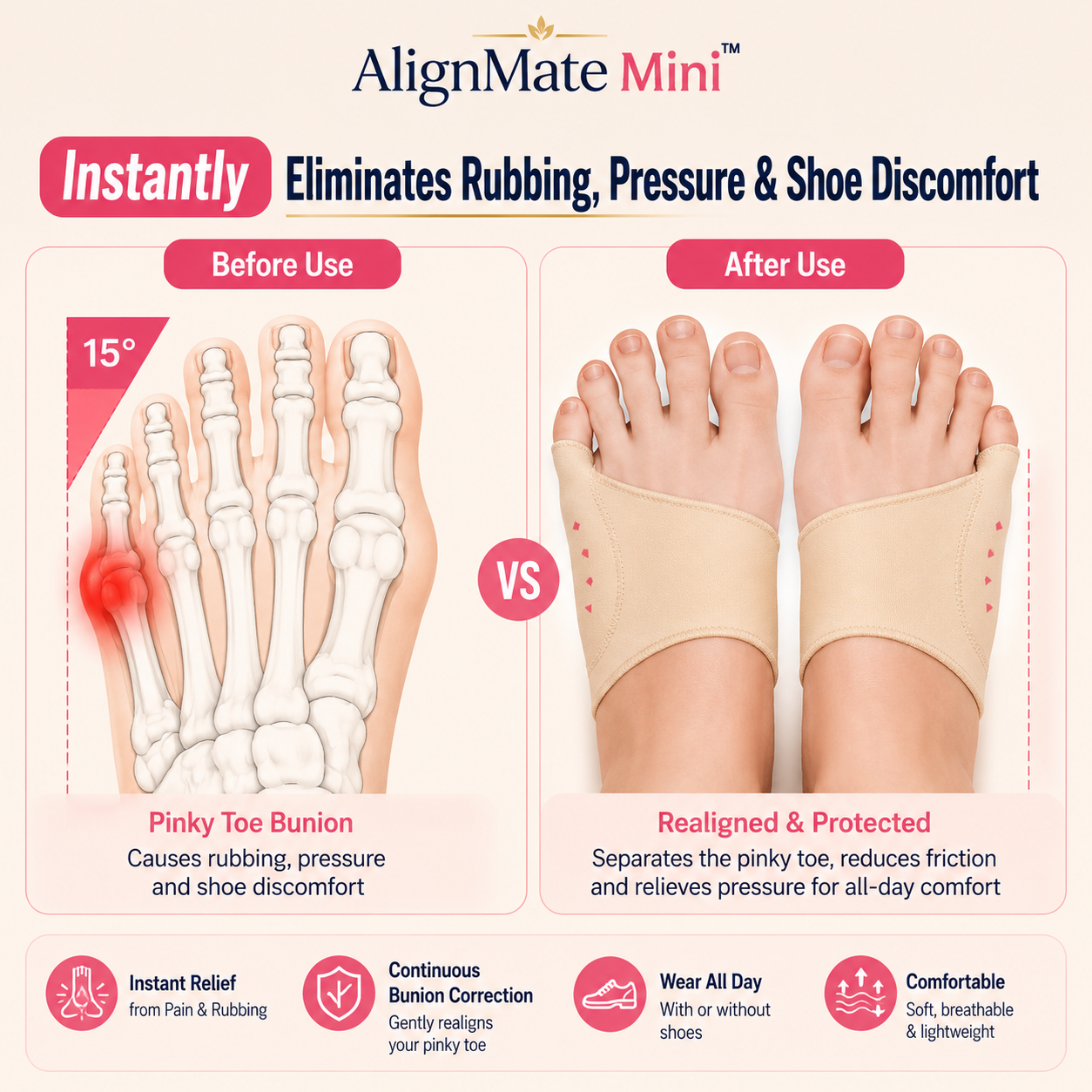 AlignMate Mini™ — First-Ever Pinky Toe Bunion Corrector