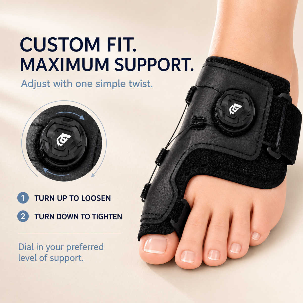 AlignMate 2.0 — Advanced Correction for Even Severe Bunions