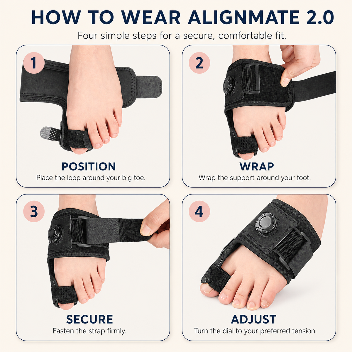 AlignMate 2.0 — Advanced Correction for Even Severe Bunions