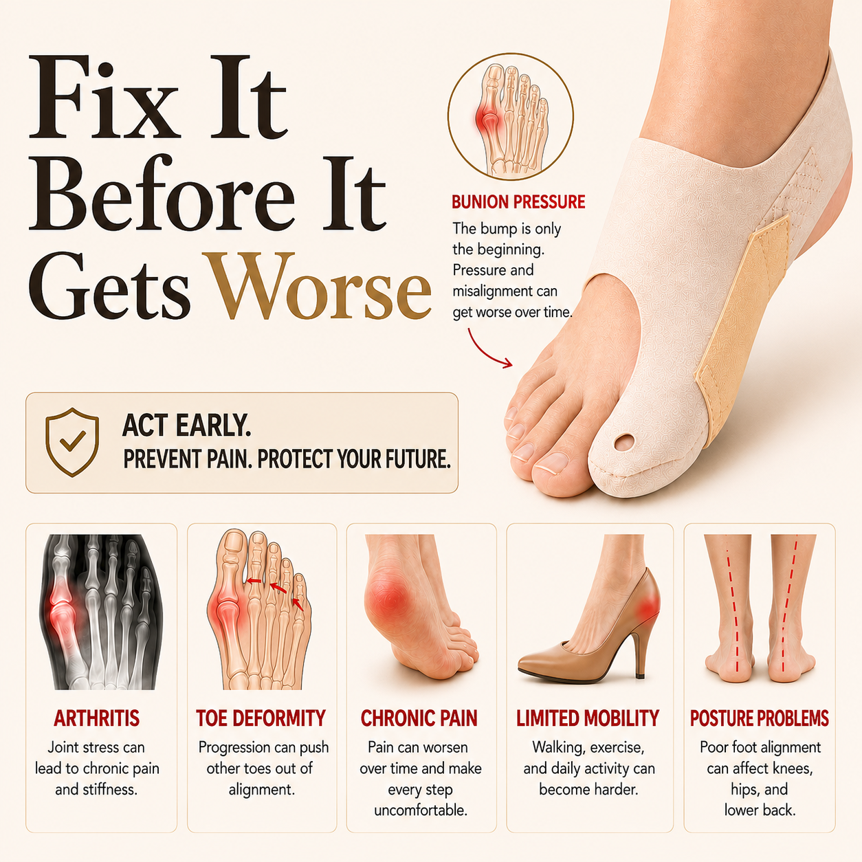 AlignMate- Fix Your Bunion Before It Gets Worse
