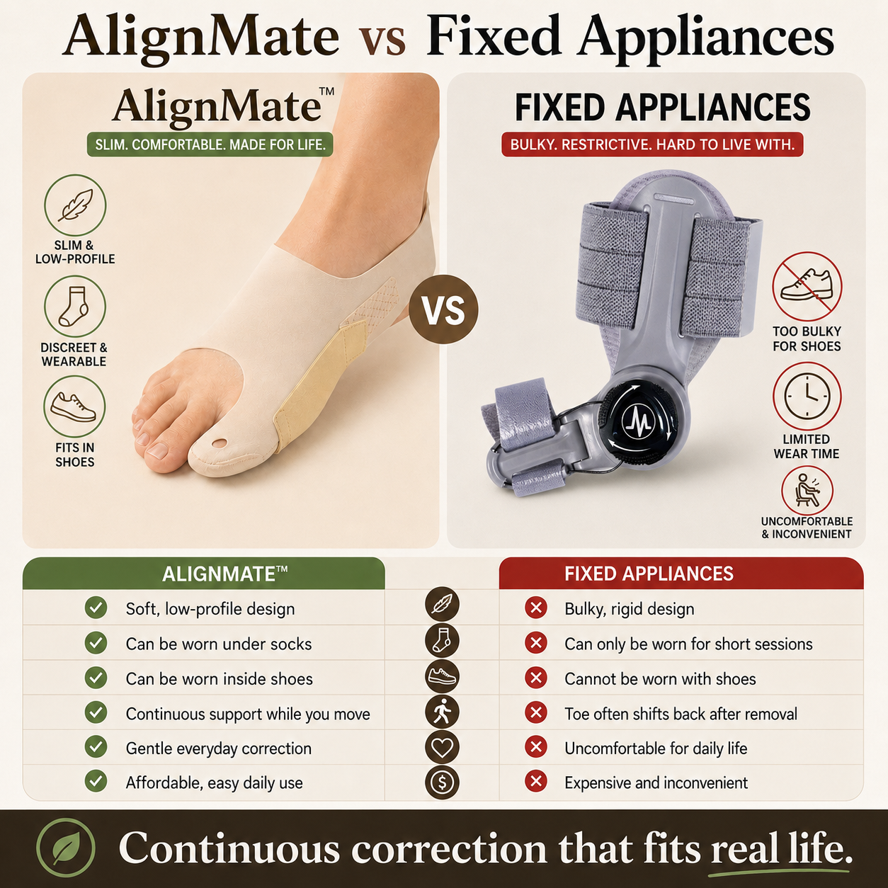 AlignMate- Fix Your Bunion Before It Gets Worse